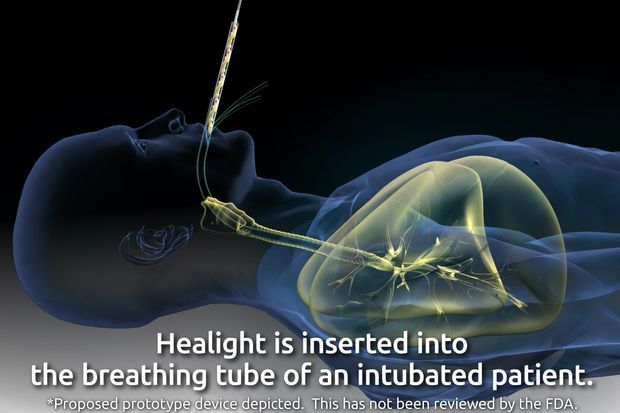 An Experimental Ultraviolet Light Treatment for Covid-19 Takes Political Heat - WSJ